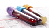 ABC OF CBC- COMPLETE BLOOD COUNT INVESTIGATION INTERPRETATIO