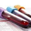 ABC OF CBC- COMPLETE BLOOD COUNT INVESTIGATION INTERPRETATIO