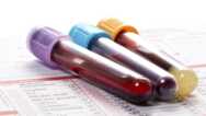 ABC OF CBC- COMPLETE BLOOD COUNT INVESTIGATION INTERPRETATIO