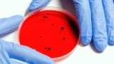 Basics Of Infection Control