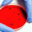 Basics Of Infection Control