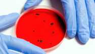 Basics Of Infection Control