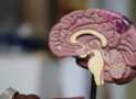 Brain anatomy
