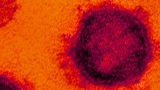 COVID-19 in Immunosuppressed Patients