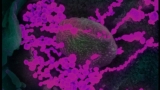 COVID-19 Pathology
