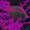 COVID-19 Pathology