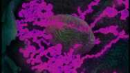COVID-19 Pathology