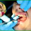 EFT Your Dentist
