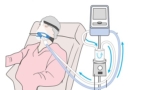 Just Breathe 101 Diaphragm in Critical Care