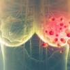 Learn To Predict Breast Cancer Using Machine Learning