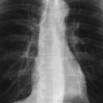 Learn X Ray Chest Interpretation – For All Doctors, Med Stud