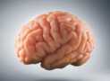Nervous System