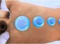 Professional Cupping Therapist Certificate Course