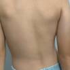 Scoliosis Management Online Course