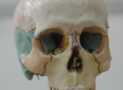 Skull anatomy