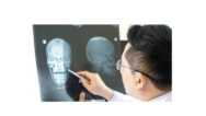 Skull and face radiography