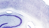 The Science of Brain Disorders