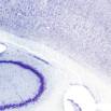 The Science of Brain Disorders