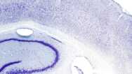 The Science of Brain Disorders