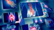 Understanding the Chronic Musculoskeletal Pain Problem